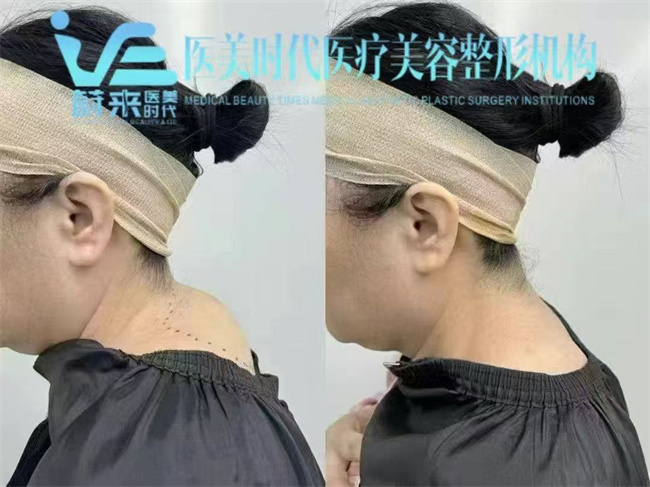 e9af0c1a09f95c4015d3e576b4f0a36_副本.jpg