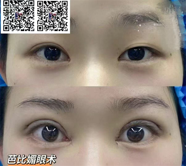 822974202618799df063f4feacffc9d_副本.jpg